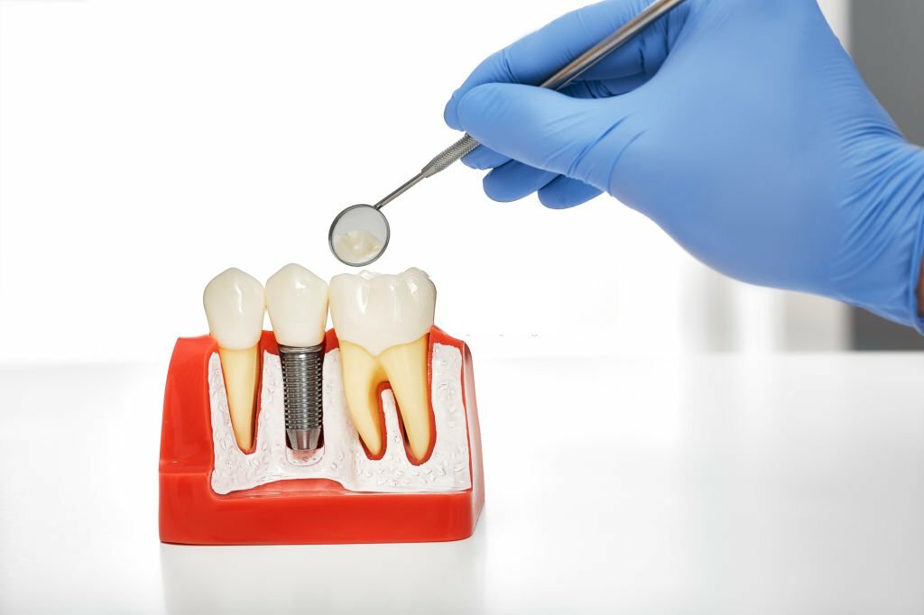 Tips to Find the Best Dentist in Delhi/NCR