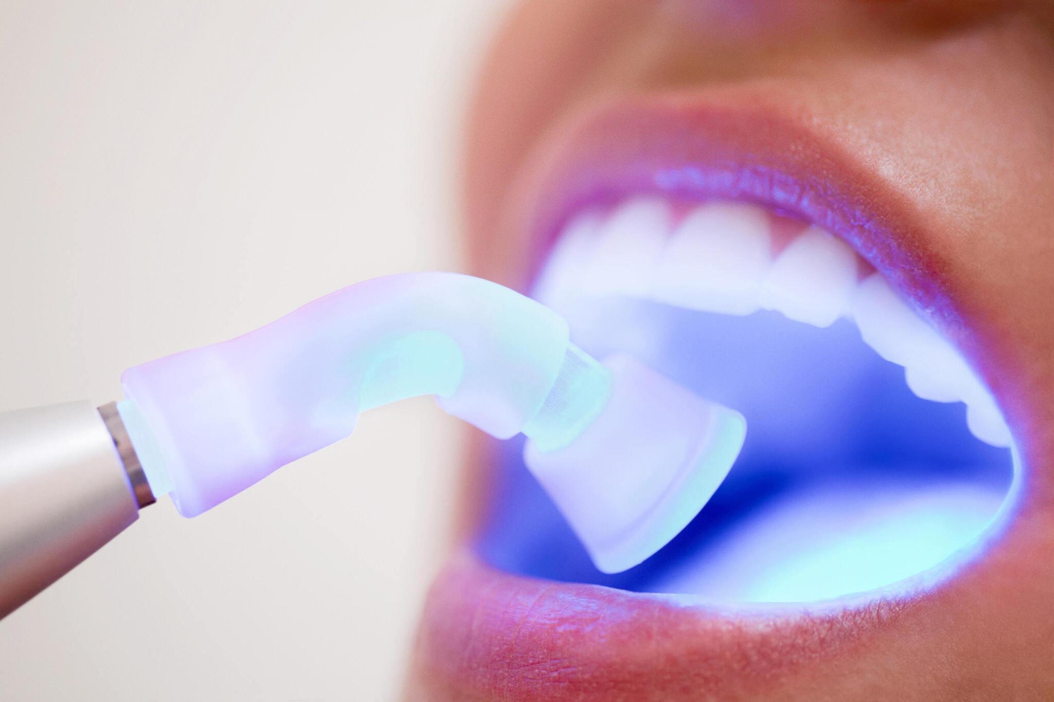 Laser Dentistry