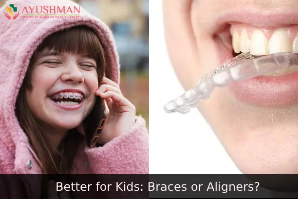Which is Better for Kids: Braces or Aligners?