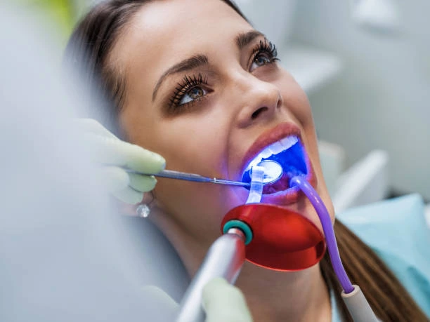 Laser Dentistry in dwarka