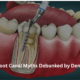 Top 7 Root Canal Myths Debunked by Dentists