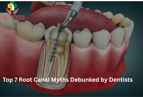 Top 7 Root Canal Myths Debunked by Dentists