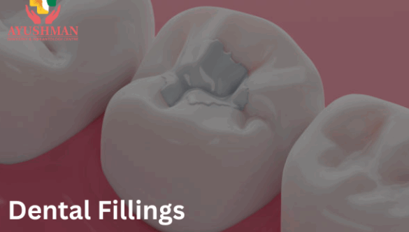 Dental Fillings: Cost, Procedure & Benefits