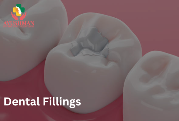 Dental Fillings: Cost, Procedure & Benefits