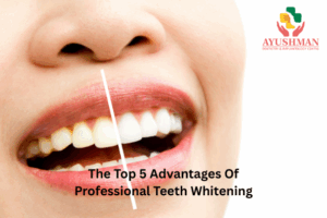The Top 5 Advantages Of Professional Teeth Whitening