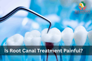 Is Root Canal Treatment Painful? Let’s Clear the Confusion 