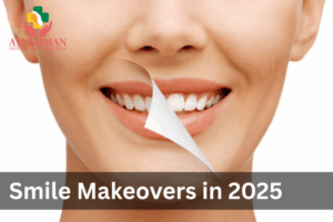 Smile Makeovers in 2025 :  Veneers, Whitening & Cosmetic Dentistry Trends