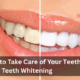 How to Takе Carе of Your Tееth Aftеr Teeth Whitеning