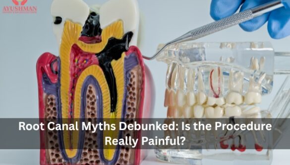 Root Canal Myths Debunked: Is the Procedure Really Painful? 