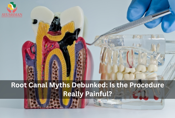 Root Canal Myths Debunked: Is the Procedure Really Painful? 