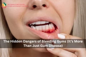The Hidden Dangers of Bleeding Gums (It’s More Than Just Gum Disease) 