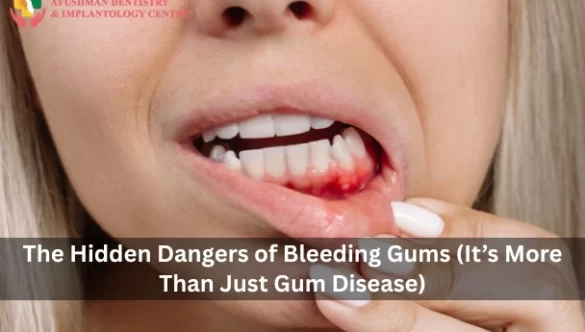 The Hidden Dangers of Bleeding Gums (It’s More Than Just Gum Disease) 