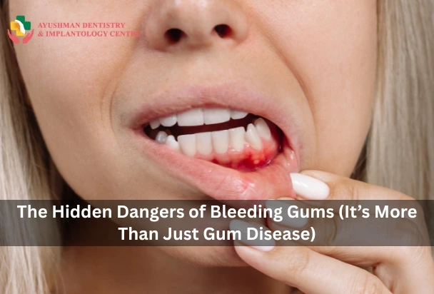 The Hidden Dangers of Bleeding Gums (It’s More Than Just Gum Disease) 