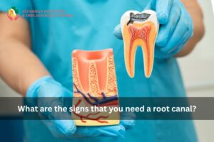 What are the signs that you need a root canal?