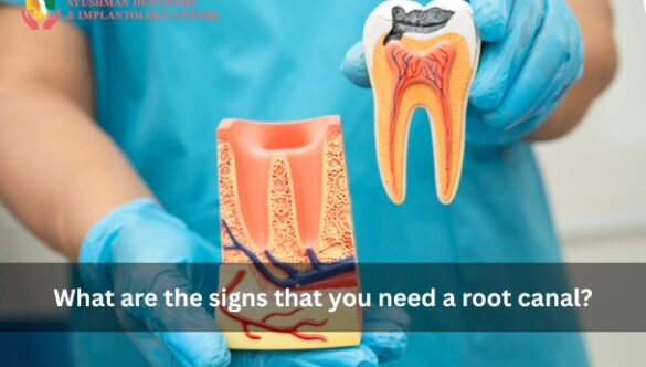 What are the signs that you need a root canal?