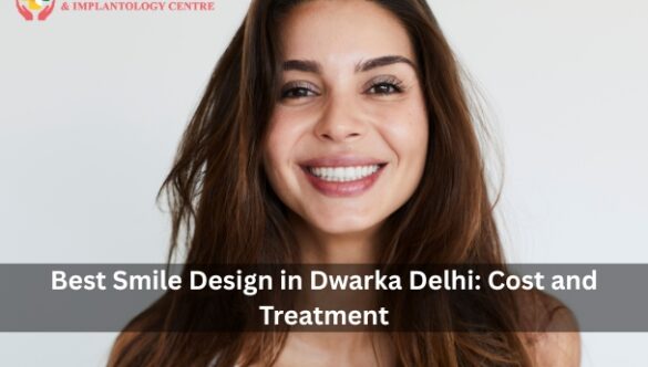Best Smile Design in Dwarka Delhi: Cost and Treatment