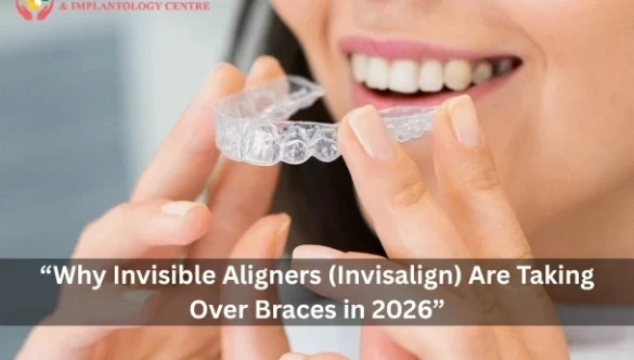 “Why Invisible Aligners (Invisalign) Are Taking Over Braces in 2026”