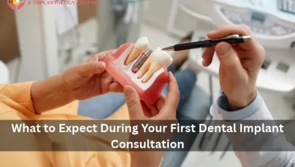 What to Expect During Your First Dental Implant Consultation